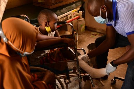 Abdishukri undergoes club foot care at the clinic