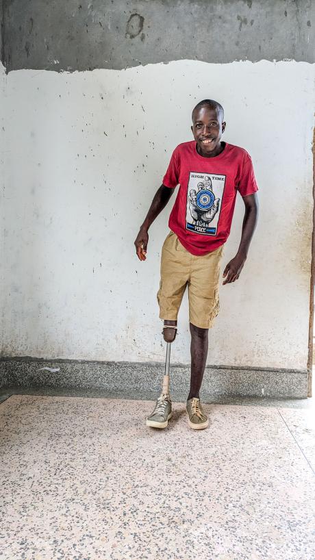 Henry Baraka radiates joy while standing on his prosthetic limb, embracing newfound happiness.